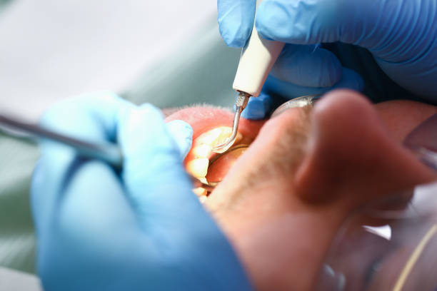 Best Dentist Open Late Near Me  in Warren, IN