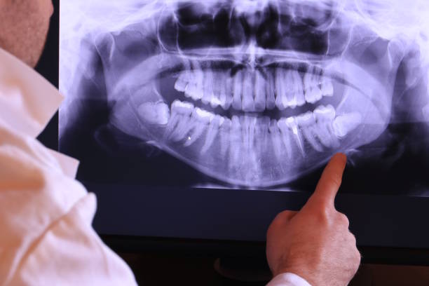 Best Tooth Pain Emergency Relief  in Warren, IN